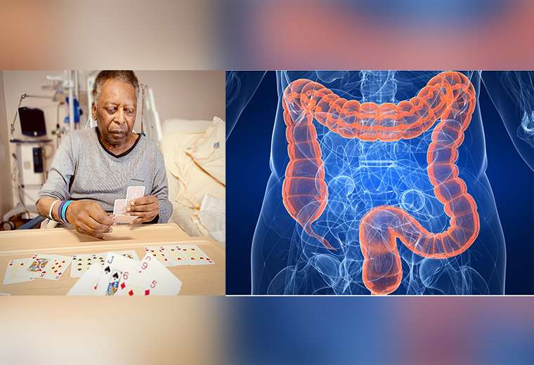 Colom Three Consejos para prevenir el cáncer de colon, la enfermedad que se llevó ...