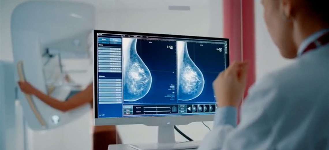 CCSS apuesta por inteligencia artificial para anticipar enfermedades - Imagen de la noticia